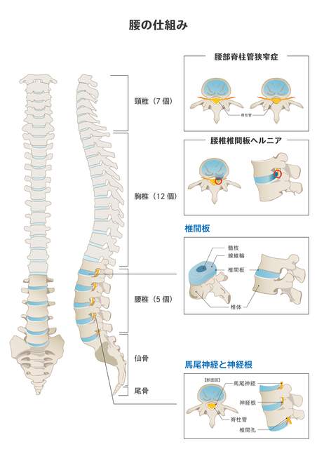 腰椎椎間板ヘルニア 北区王子駅 腰痛 しびれの改善なら 王子じんかわ整体 椎間板ヘルニア 坐骨神経痛